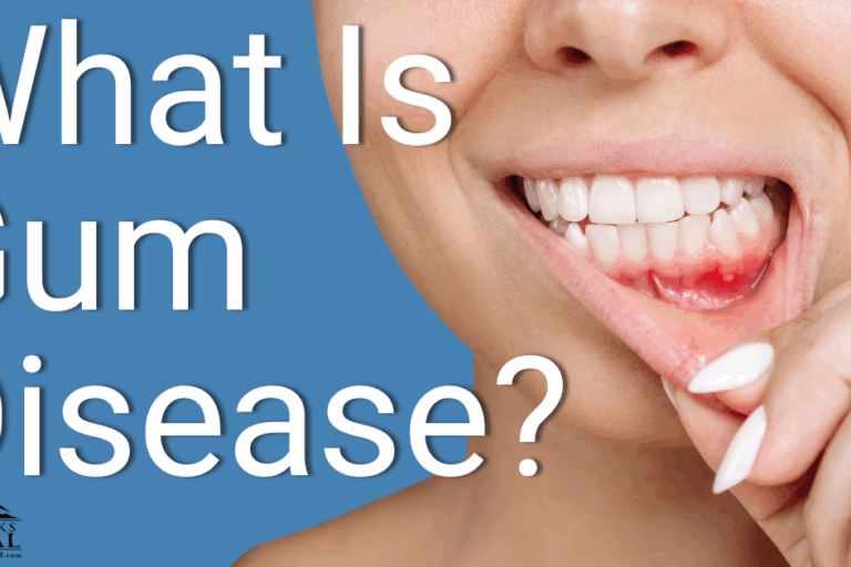 Caldon Blog June 2025