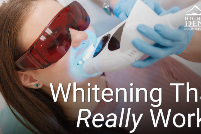 Caldon Blog January 2025