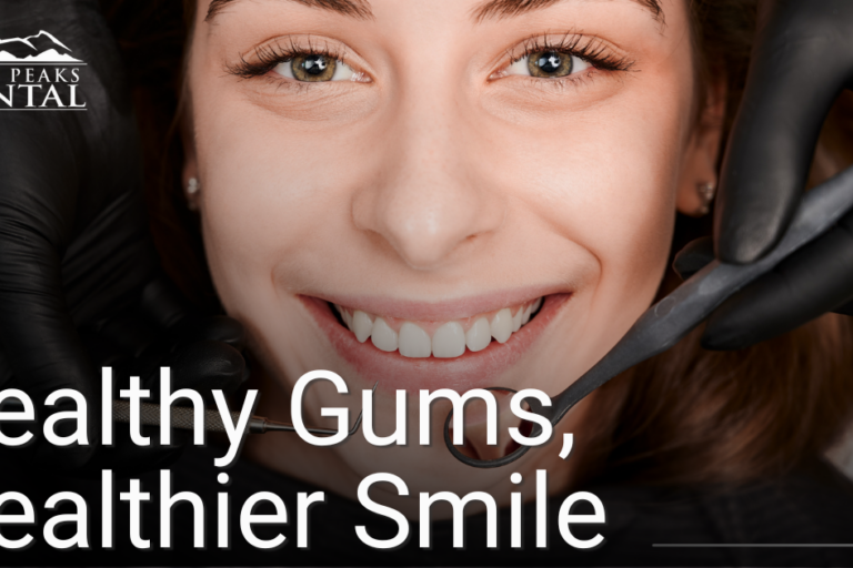 Caldon Email February 2026