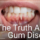 patient showing gums