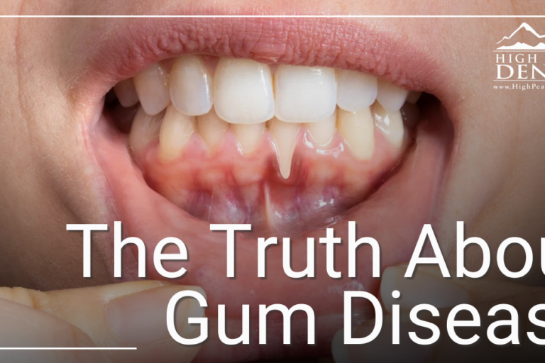 patient showing gums