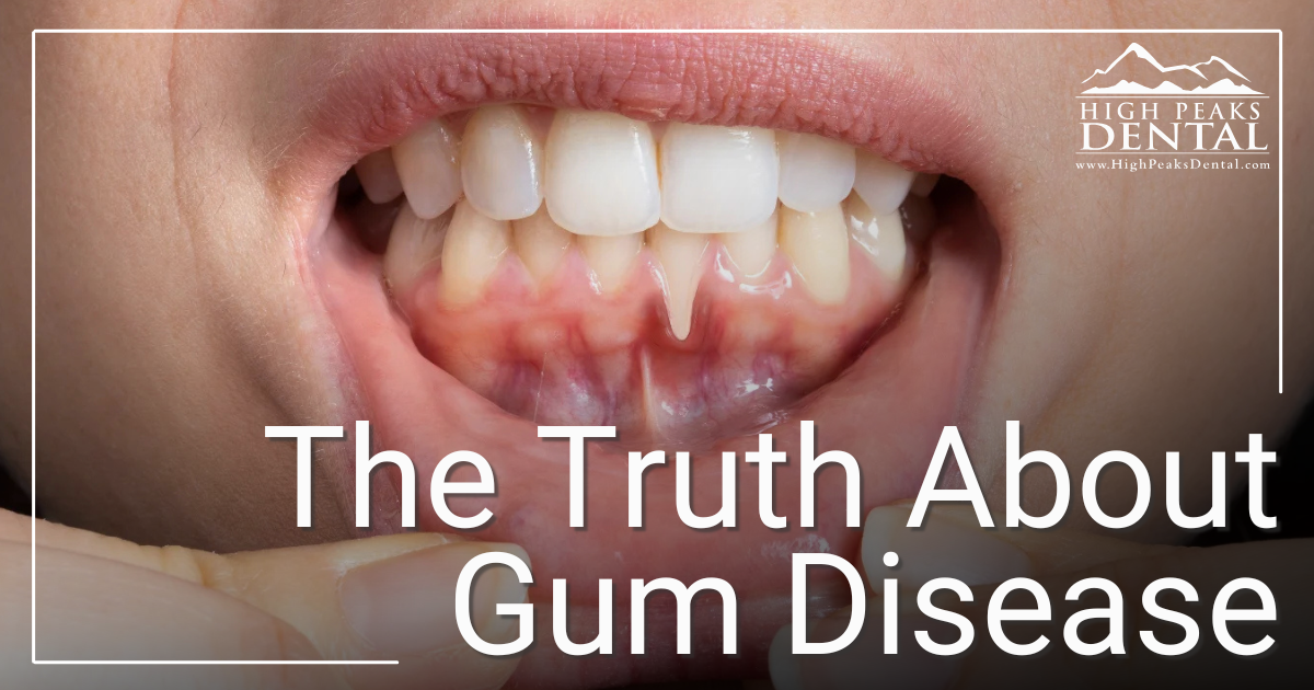 patient showing gums